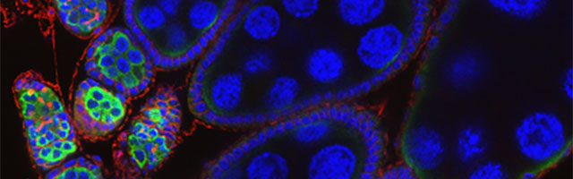 wt_oocyte_01.jpg