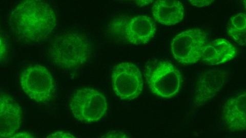 Image of green fluorescence in GFP-tagged Drosophila cultured cells