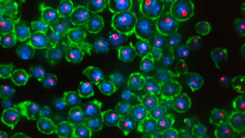 Screenshot of a microscope image available online at HMS OMERO